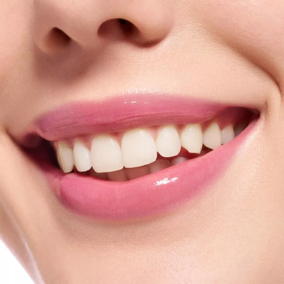 Нажмите на картинку, чтобы ее увеличить ESSENCE EXTREME SHINE БЛЕСК ДЛЯ ГУБ 103 PRETTY IN PINK