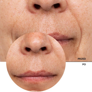Revox B77 Just Retinol In Squalane H2O-Free Solution — сыворотка для лица с ретинолом и скваланом, 30 мл