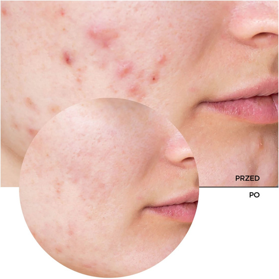 Revox B77 Just Niacinamide 10% Daily Moisturiser — сироватка для обличчя з 10% ніацинамідом, 30 мл