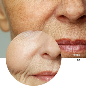 Revox B77 Just Glycolic Acid 20% Toning Solution — тоник для лица и шеи с 20% гликолевой кислотой, 30 мл