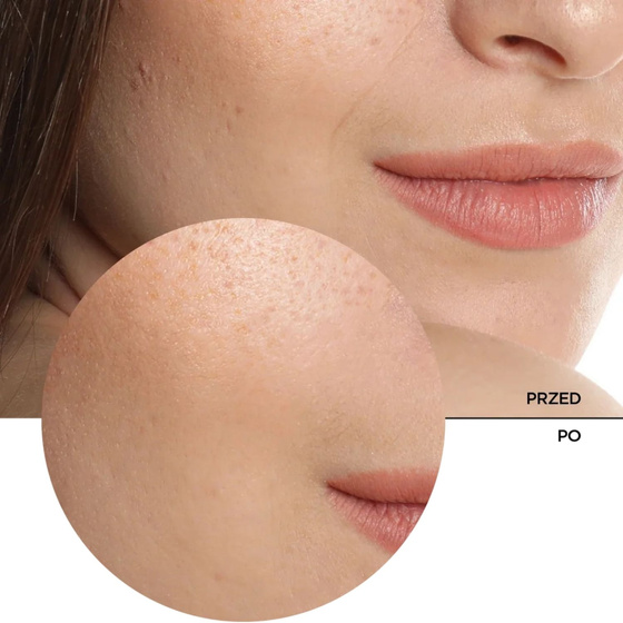 Натисніть на картинку, щоб її збільшити Revox B77 Just Hyaluronic Acid 5% Hydrating Fluid — зволожуюча сироватка для обличчя з 5% гіалуроновою кислотою, 30 мл