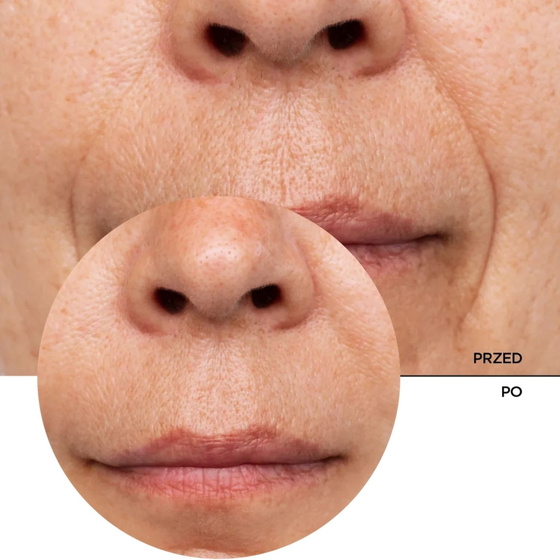 Revox B77 Just Retinol In Squalane H2O-Free Solution — сироватка для обличчя з ретинолом і скваланом, що запобігає старінню, 30 мл