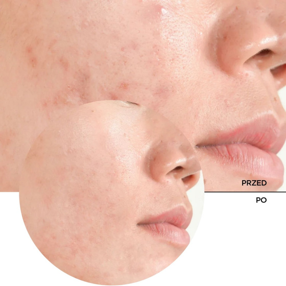 Revox B77 Just Salicylic Acid 2% Peeling Solution — отшелушивающий пилинг для лица с 2% салициловой кислотой, 30 мл