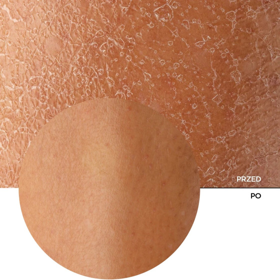 Revox B77 Just Marine Collagen + HA Algae Solution — увлажняющая сыворотка для лица с коллагеном и гиалуроновой кислотой, 30 мл