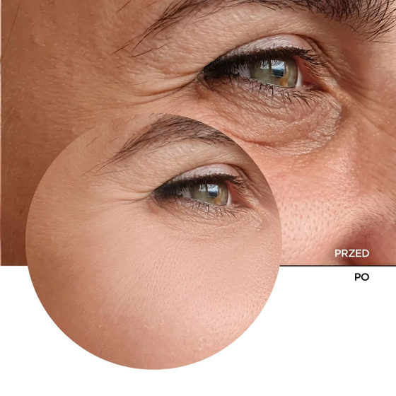 Revox B77 Just Retinal 0,2% Anti-Aging Fluid — антивозрастной крем с 0,2% ретинолом для ночного ухода, 30 мл