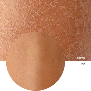 Revox B77 Just Marine Collagen + HA Algae Solution — увлажняющая сыворотка для лица с коллагеном и гиалуроновой кислотой, 30 мл